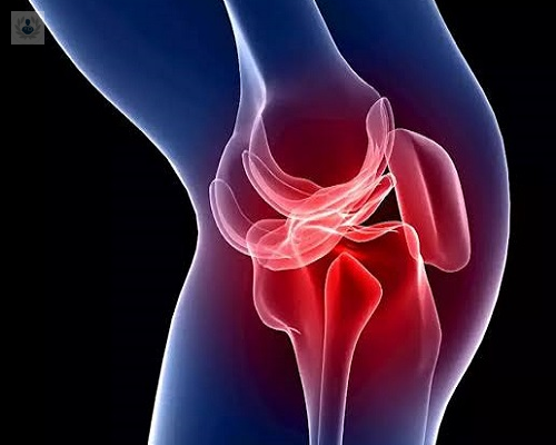Dolor Articular de Rodilla, Cadera y Hombro causadas por Artrosis: formas de tratamiento