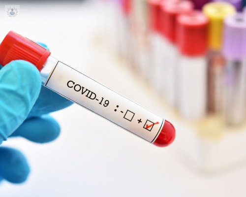 Colombia en fase de mitigación del Coronavirus