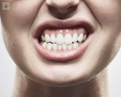 bruxismo-conoce-las-causas-y-tratamiento imagen de artículo