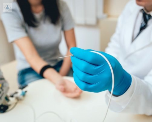 que-es-la-electromiografia imagen de artículo