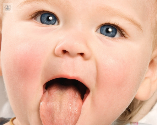 frenillo-lingual-como-afecta imagen de artículo