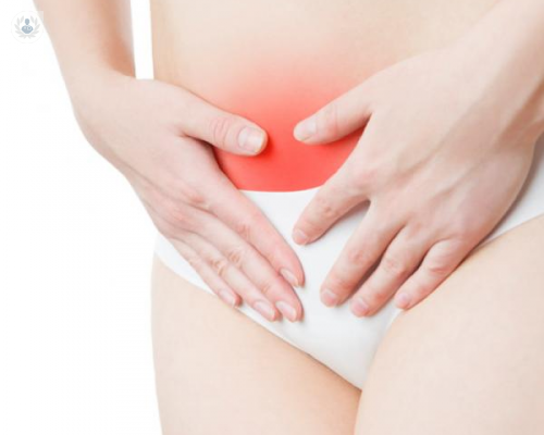 Síndrome de Ovario Poliquístico: lo que debes saber