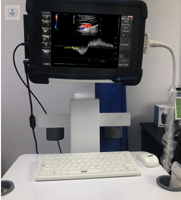 ecografia-doppler-para-diagnostico-enfermedades-vasculares imagen de artículo