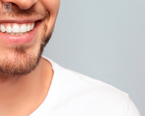 diseno-de-sonrisa-todo-lo-que-debes-saber-sobre-este-tratamiento imagen de artículo