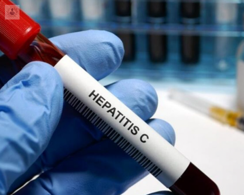 Hepatitis C: lo que debe saber