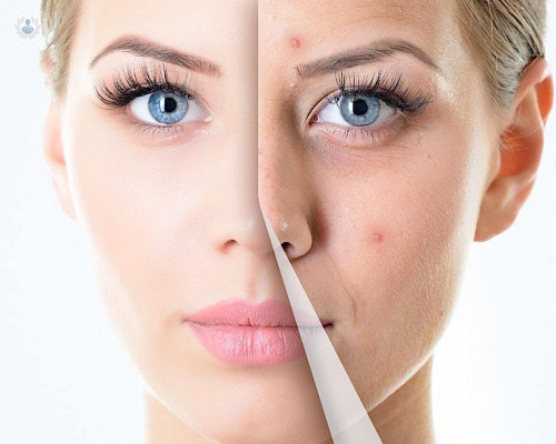 peeling-facial-lo-que-debes-saber-sobre-el-procedimiento-de-la-exfoliacion-facial imagen de artículo