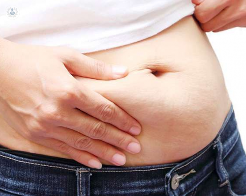 la-cirugia-bariatrica-y-su-relacion-con-la-perdida-de-peso imagen de artículo