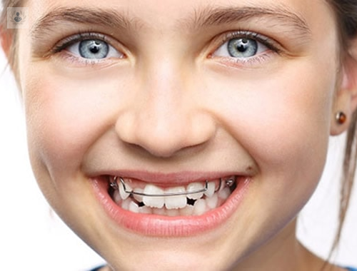 ortopedia-maxilar-para-ninos-es-recomendable imagen de artículo