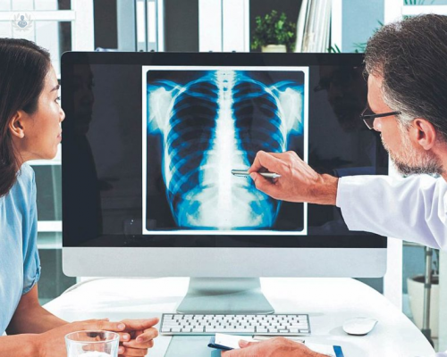 el-estres-podria-activar-las-celulas-cancerigenas imagen de artículo