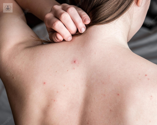 cancer-de-piel-ventajas-de-las-tecnicas-quirurgicas-para-su-tratamiento imagen de artículo