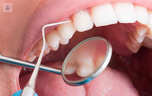 Periodontitis podría provocar Demencia