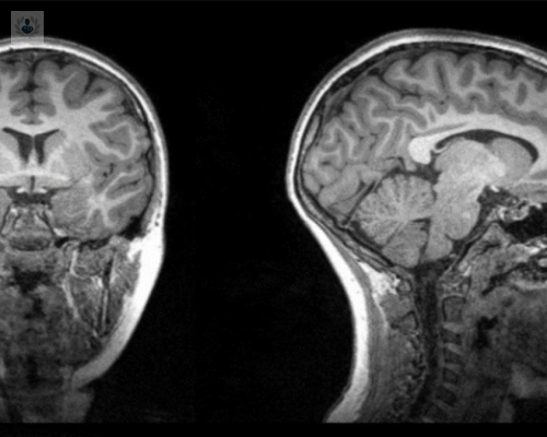 Tratamientos contra el SARS-CoV-2 podrían dañar tu cerebro