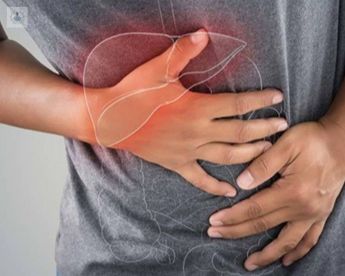 por-que-la-cirrosis-es-una-enfermedad-cronico-degenerativa imagen de artículo