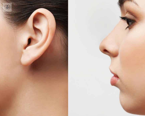 rinoplastia-a-que-edad-me-la-puedo-hacer imagen de artículo