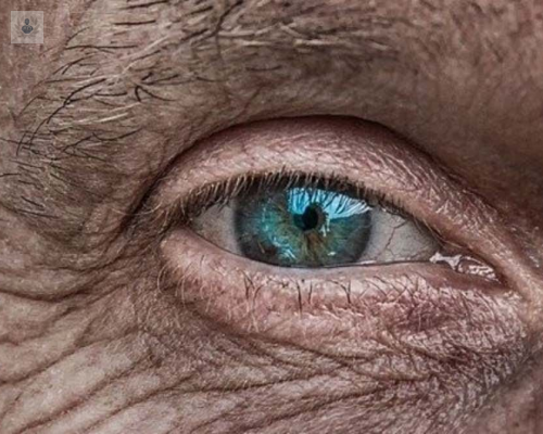 degeneracion-macular-relacionada-con-la-edad imagen de artículo