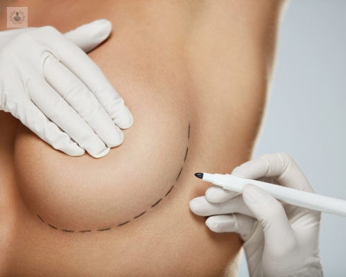 aumento-mamario-protesis-o-inyeccion-de-grasa imagen de artículo