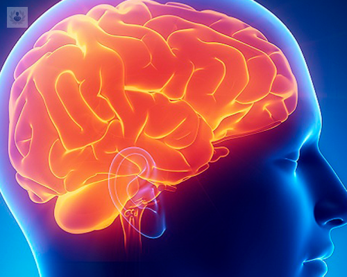 alzheimer-sintomas-y-tratamiento-de-la-enfermedad imagen de artículo