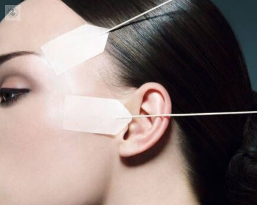 hilos-tensores-faciales-con-pdo-una-tecnica-terapeutica-benefica imagen de artículo