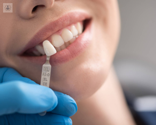Cuidado de Implantes Dentales