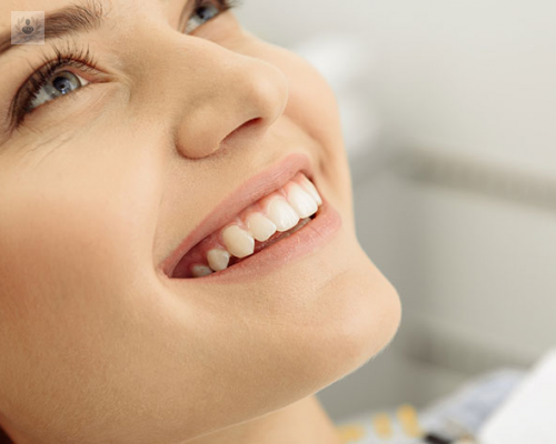 Estética en Implantes Dentales
