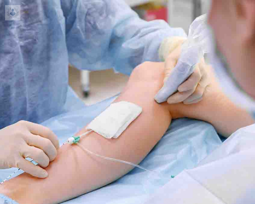 cirugia-vascular-para-que-sirve imagen de artículo