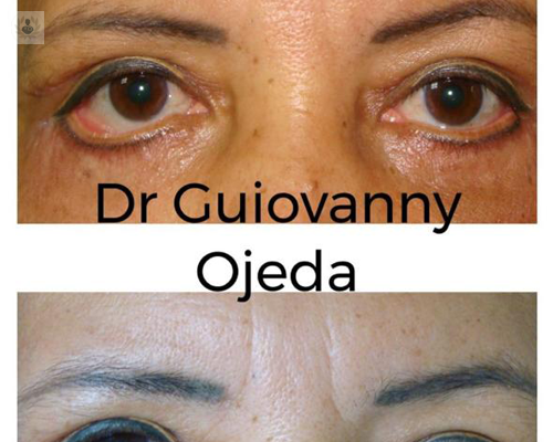 fox-eyes-la-tendencia-en-el-aspecto-de-la-mirada imagen de artículo