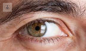 ventajas-del-trasplante-de-cornea-endotelial imagen de artículo
