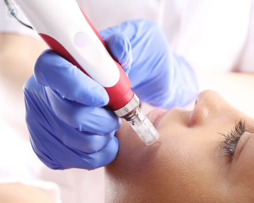 biorevitalizacion-facial-con-nanotecnologia imagen de artículo