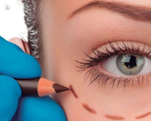 oculoplastia-una-subespecialidad-que-puede-corregir-afecciones-alternas-al-ojo imagen de artículo