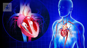 Complicaciones Cardiovasculares y COVID-19