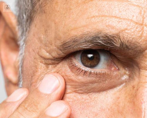 glaucoma-una-enfermedad-derivada-por-la-atrofia-del-nervio-optico imagen de artículo