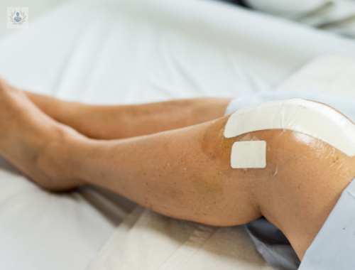 reemplazo-total-de-rodilla-un-procedimiento-que-da-vida-a-la-movilidad imagen de artículo