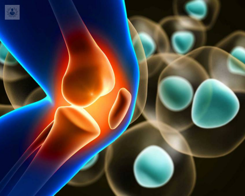 celulas-madre-un-nuevo-tratamiento-para-recuperar-la-movilidad-de-la-rodilla imagen de artículo