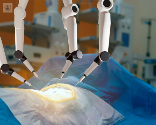 cirugia-bariatrica-robotica imagen de artículo