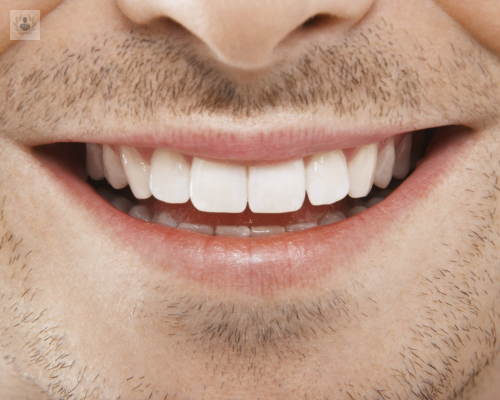la-tendencia-de-hoy-sonrisas-naturalmente-bellas imagen de artículo