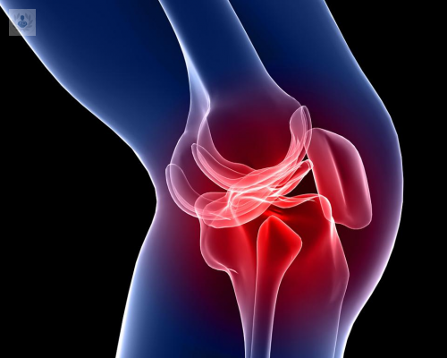 reemplazo-de-rodilla-un-procedimiento-para-acabar-con-el-dolor imágen de artículo