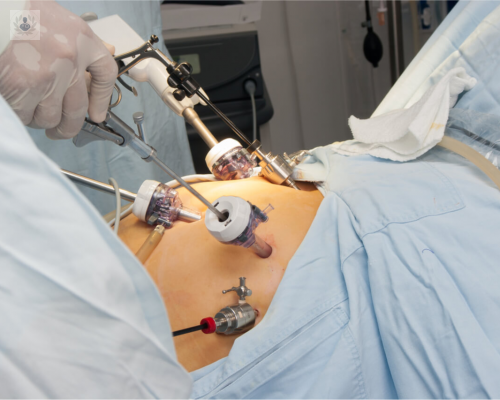 reparacion-endoscopica-preaponeurotica-repa imagen de artículo