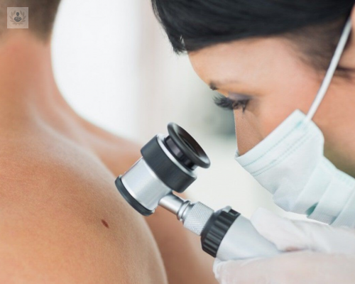 cirugia-de-mohs-un-procedimiento-quirurgico-contra-el-cancer imagen de artículo