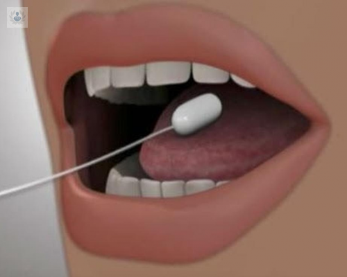 balon-gastrico-ingerible imagen de artículo