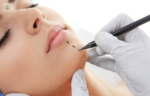 cinco-pasos-a-seguir-para-realizarte-una-cirugia-plastica imagen de artículo