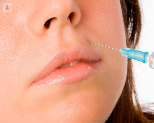 acido-hialuronico-lo-que-debes-saber imagen de artículo