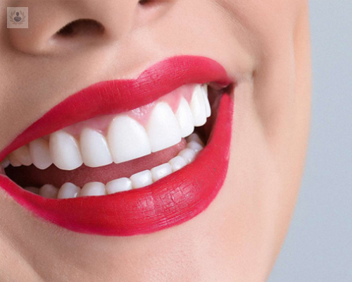 curiosidades-de-los-disenos-de-sonrisa imagen de artículo