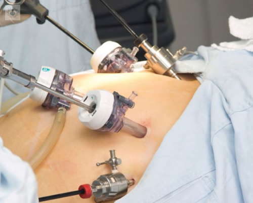 beneficios-de-la-cirugia-bariatrica imagen de artículo