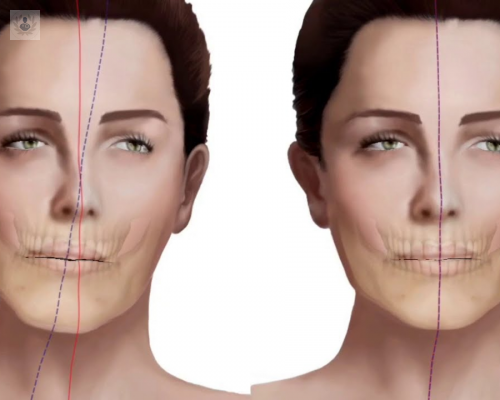 Problemas Esqueléticos Faciales: todo lo que tienes que saber