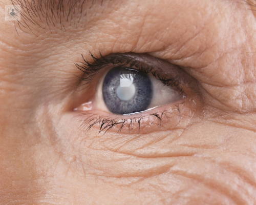 principales-enfermedades-de-los-ojos imagen de artículo