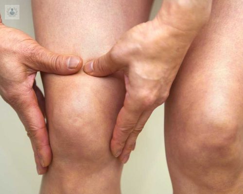 La hinchazón de las piernas y tobillos puede estar ocasionada por Nefropatía Membranosa