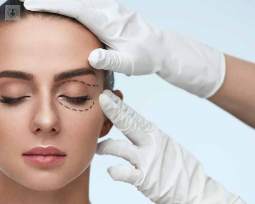 blefaroplastia-todo-lo-que-necesitas-saber imagen de artículo