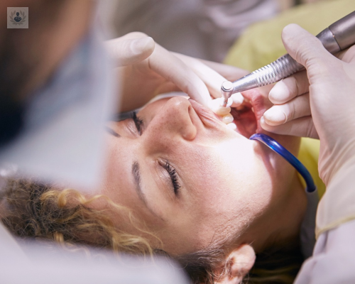 cuidados-postratamientos-dentales-cosmeticos imagen de artículo