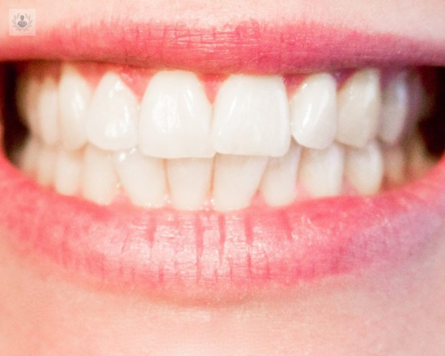 estas-apretando-los-dientes-al-dormir-esto-te-interesa imagen de artículo