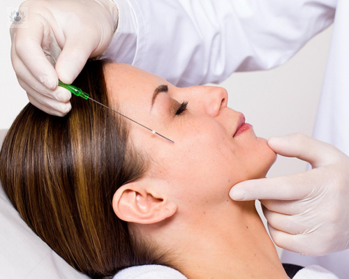 hilos-pdo-de-colageno-lisos imagen de artículo